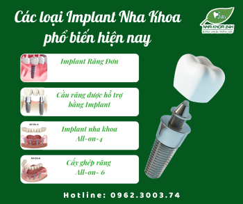 CÁC LOẠI IMPLANT NHA KHOA PHỔ BIẾN HIỆN NAY