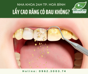 CẠO VÔI RĂNG, LẤY CAO RĂNG CÓ ĐAU KHÔNG?