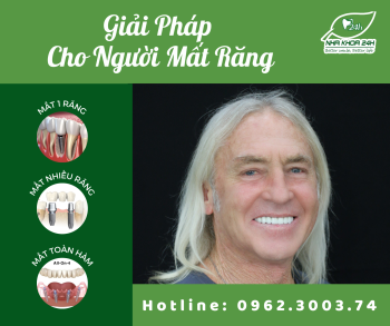 GIẢI PHÁP NÀO DÀNH CHO NGƯỜI MẤT 1 RĂNG, MẤT NHIỀU RĂNG, MẤT RĂNG TOÀN HÀM