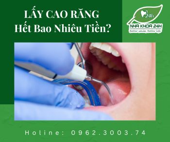 LẤY CAO RĂNG GIÁ BAO NHIÊU TIỀN?