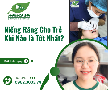 NIỀNG RĂNG CHO TRẺ TỪ MẤY TUỔI