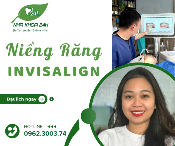NIỀNG RĂNG INVISALIGN LÀ GÌ?
