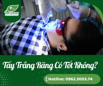 TẨY RĂNG CÓ TỐT KHÔNG?
