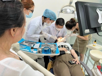 TRÁM BÍT HỐ RÃNH (SEALANT) GIÚP PHÒNG NGỪA SÂU RĂNG HIỆU QUẢ