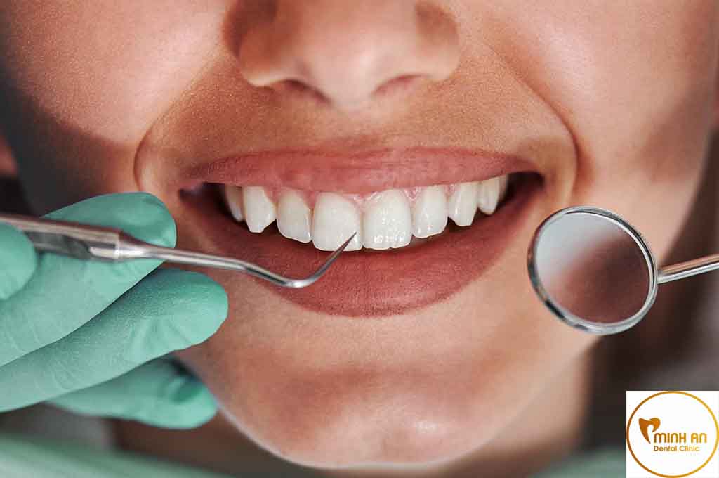 TẨY TRẮNG RĂNG CÓ ĐAU KHÔNG?