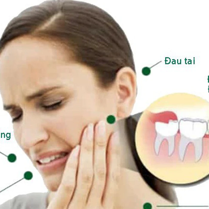 NGUYÊN NHÂN ĐAU RĂNG KHÔN