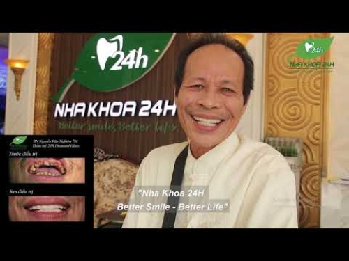 Bệnh nhân làm phục hình thẩm mỹ 23R sứ Diamond Glass tại Nha Khoa 24H-TP. Hòa Bình