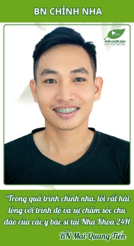 Niềng răng mắc cài sứ dễ dàng thoải mái hơn nhiều – Thái Hoàng Dũng